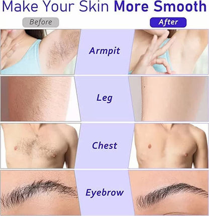 3-in-1 Roll-On Waxing Deal